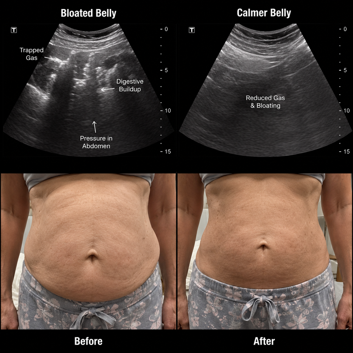 Castor Oil Belly Comfort Kit