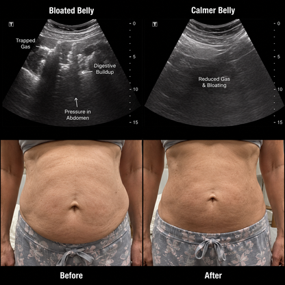 Castor Oil Belly Comfort Kit